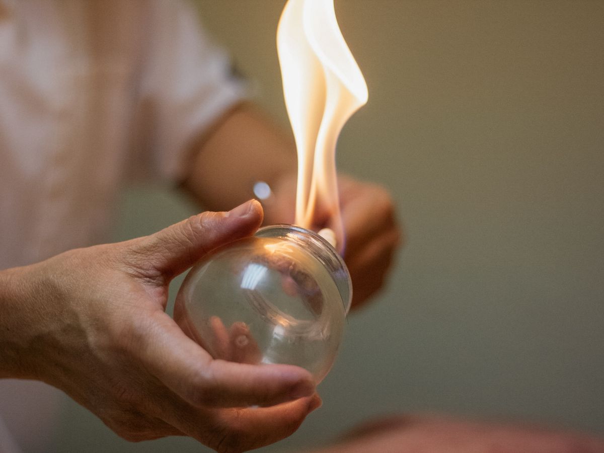 Fire cupping therapy at Ocean Breeze Spa
